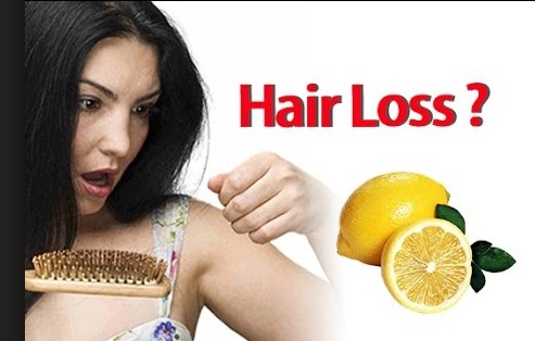 Lemon Juice To Stop Hair Fall