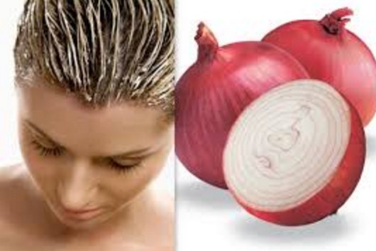 Onion and lemon juice To Get Rid Of White Hairs