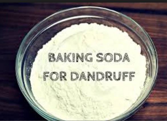 baking soda for dandruff