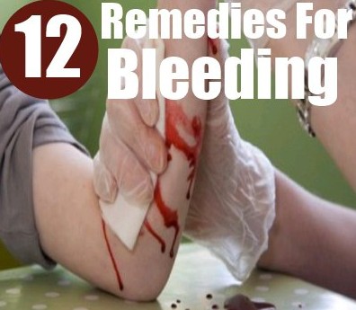 home remedies To Stop Bleeding