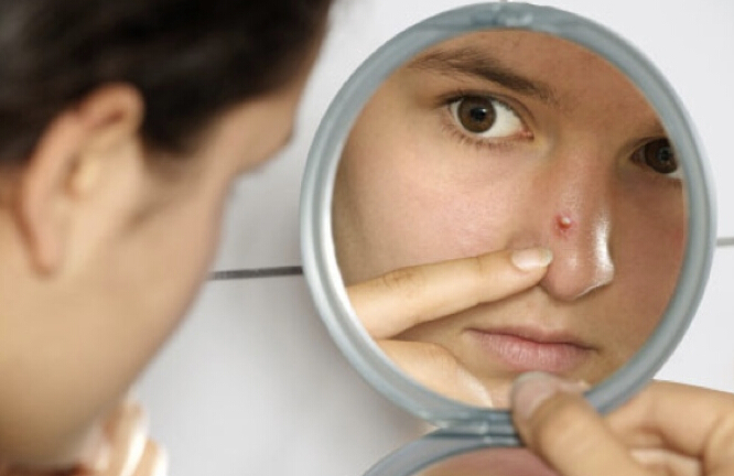 How To Get Rid Of Pimple On The Tip Of Nose